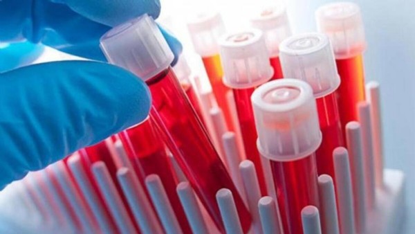 CRP Yüksekliği Nedir? CRP Yüksekliği Neden Olur? CRP Yüksekliği Nasıl Tedavi Edilir? CRP Yüksekliği Nedir? CRP Yüksekliği Neden Olur? CRP Yüksekliği Nasıl Tedavi Edilir?